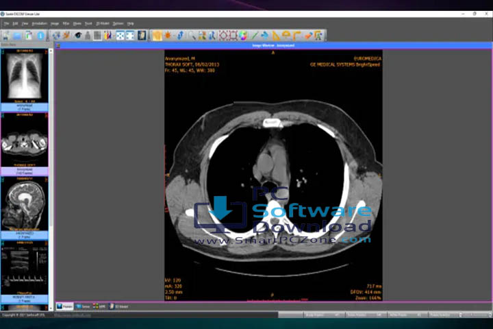 Sante PACS Server v4.4.5 [Free Download]